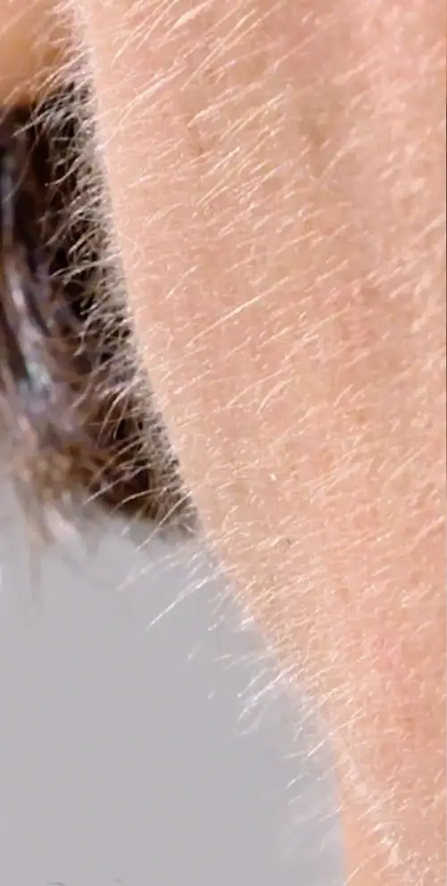 dermaplaning Avant: duvet mandibule inférieure droite