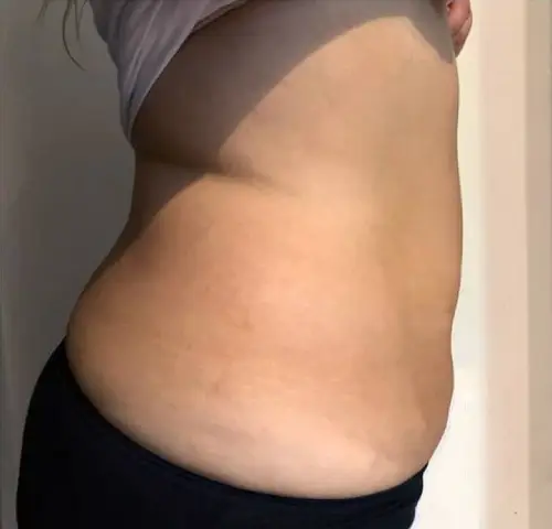 4 en 1 après