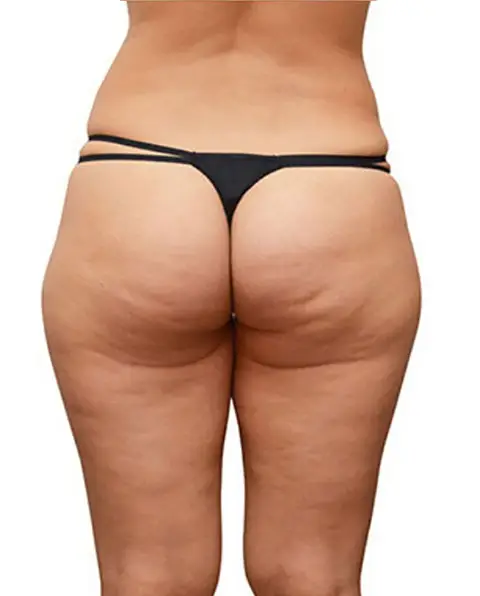 4 en 1 fesses avant