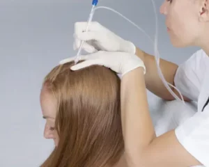 JetPeel_cheveux - soin du cuir chevelu pour pousse de cheveux