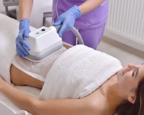 cryolipolyse placement de la ventouse refroidissante - élimination de bourrelet de graisse persistante