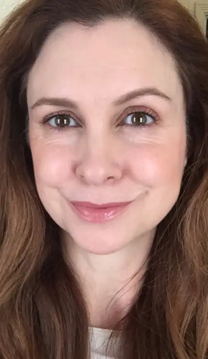 État du visage après le skinlift