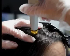 hydrafacial keravive ACB