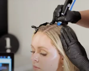 processus du soin hydrafacial keravive en phase exfoliation