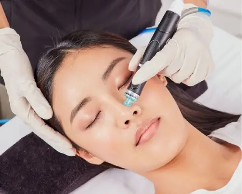 hydrafacial syndeo process