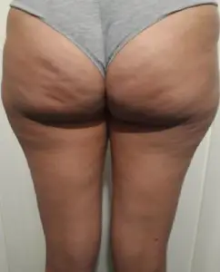 État des jambes avant 6 en 1