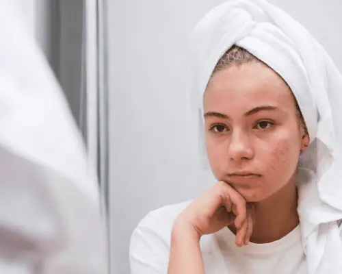 neurobeauté_stress