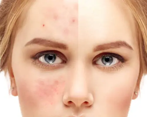 soin visage signature IMC - soin peau grasse purifiant éclat