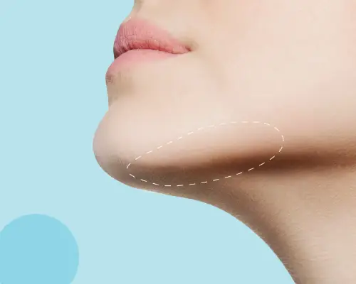 Meilleur centre pour la lipocavitation du menton et joues relâchées à Nancy