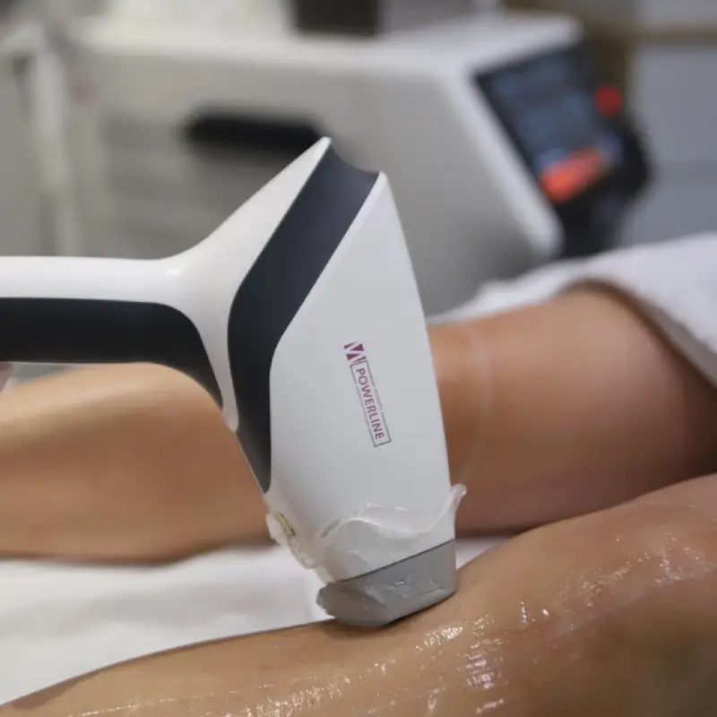 épilation laser - centre laser à Metz
