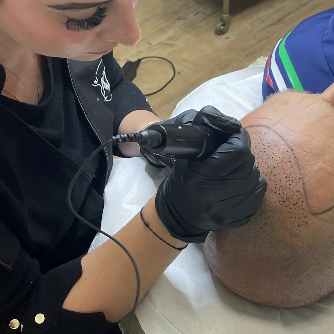 tricopigmentation