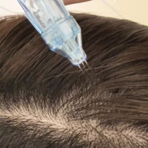 JetPeel capillaire