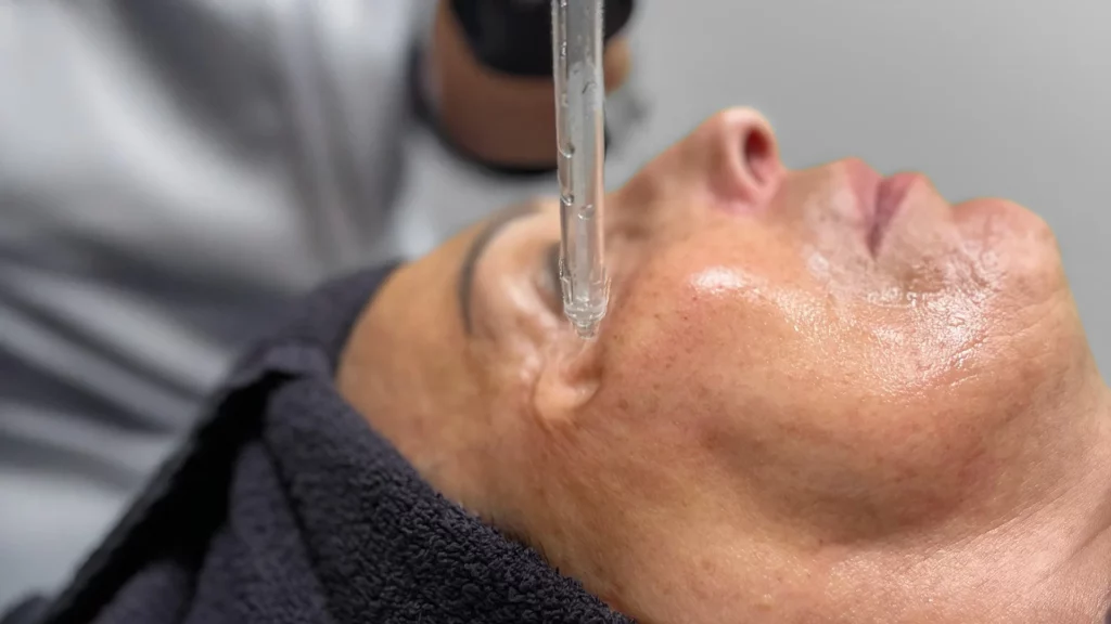 JetPeel