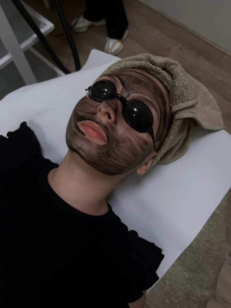 CarbonPeel