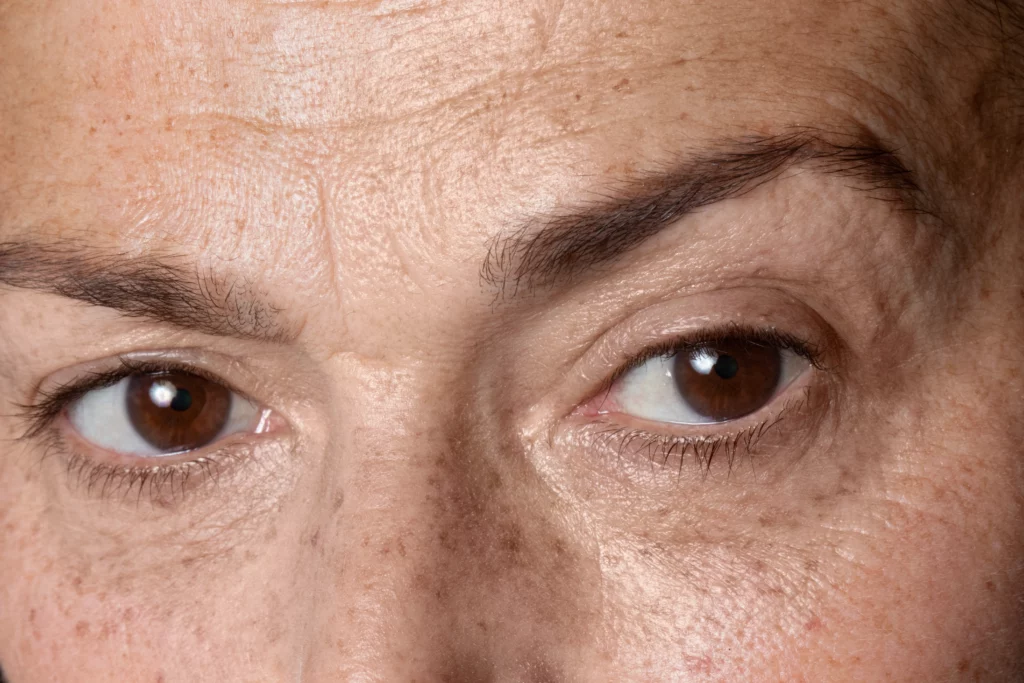 SkinFocus2