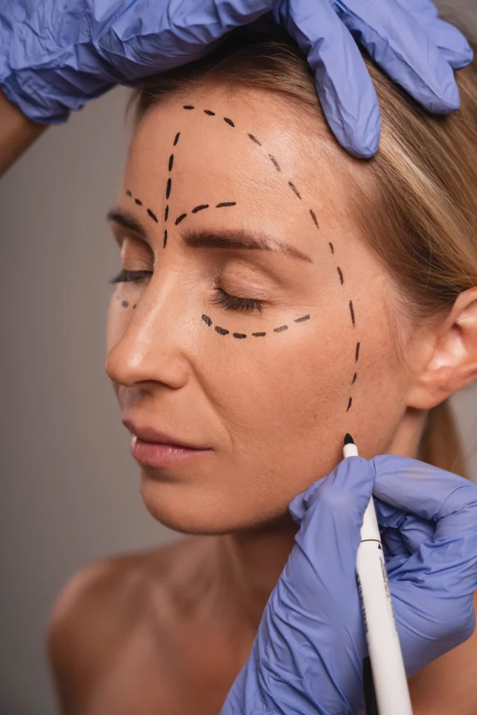 SkinLift