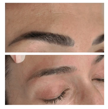 Avant après détatouage maquillage permanent sourcils – 2 séances – A'Corps Beauté